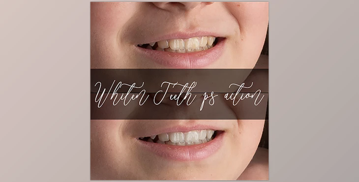 Sweet Soul Studio – Whiten Teeth Action