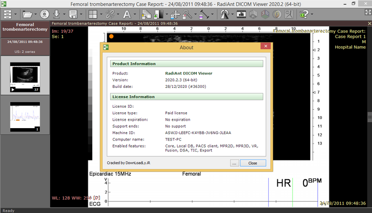 RadiAnt DICOM Viewer 2025.1