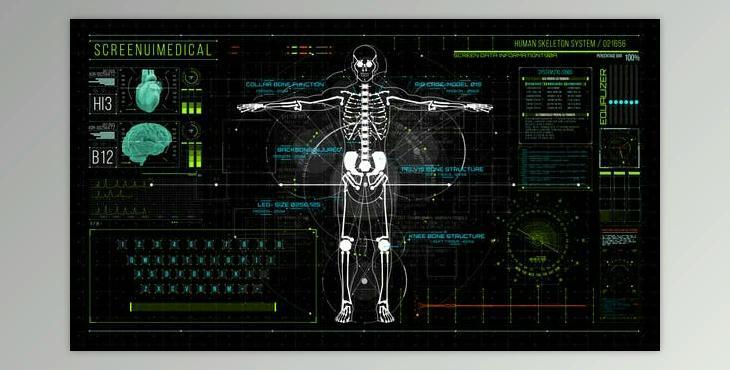 HUD700 Screen MEDICAL1 (Videohive 46261699) - AE Project