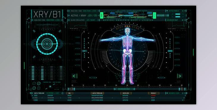 HUD Medical Body (Videohive 52878113) - AE Project