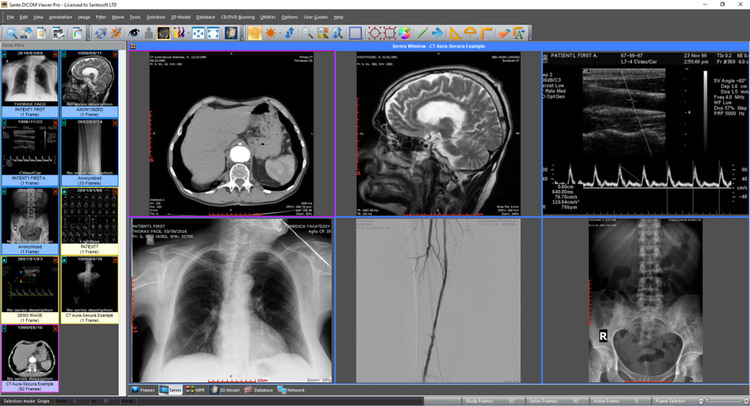 Sante DICOM Viewer Pro 14.2.3