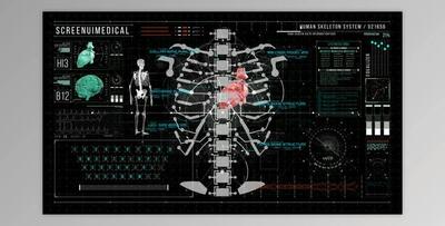 HUD700 Screen MEDICAL3 (Videohive 46324500) - AE Project