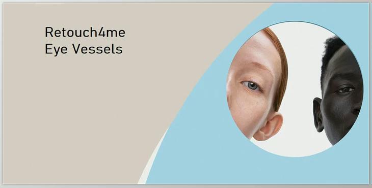 Retouch4me Eye Vessels v1.010