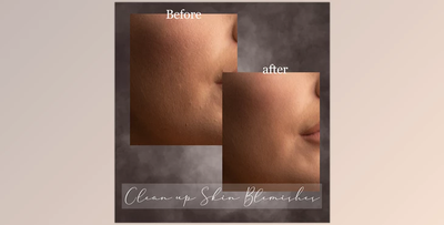 Sweet Soul Studio – Clean up Skin Blemishes